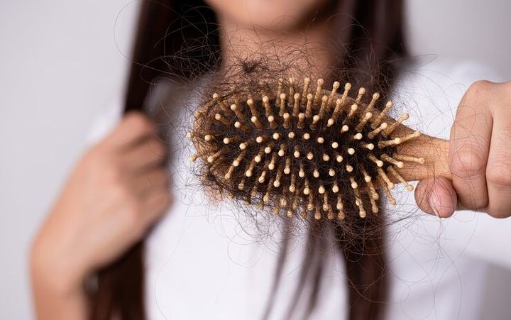 Hair Loss Explained: Common Causes, Effective Treatments, and Healthy Hair Care
